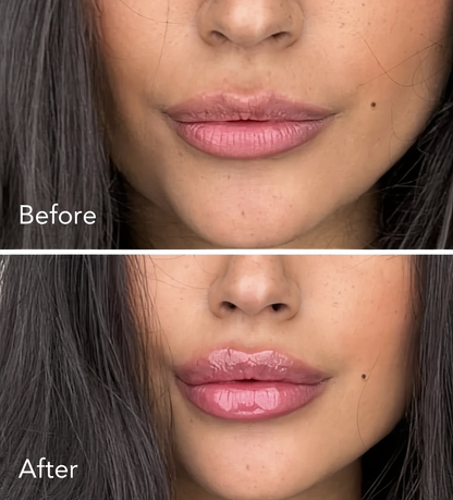 Lip Plumber